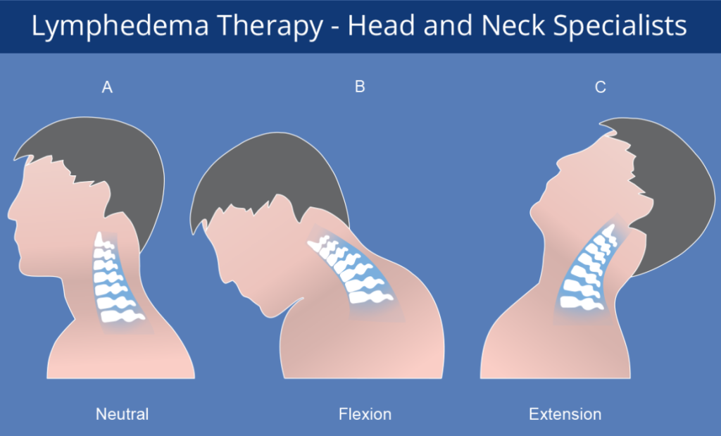 Lymphedema Therapy: Head and Neck Specialists | The Norton School Blog